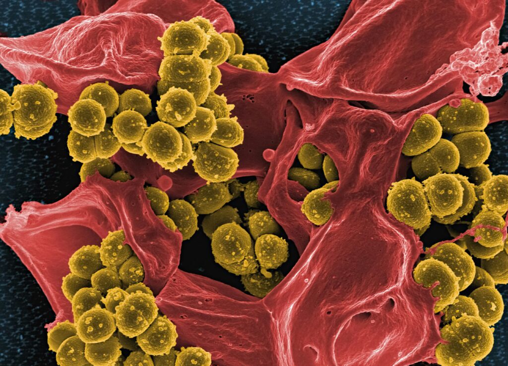 Ảnh hiển vi điện tử quét màu chụp lại vi khuẩn Staphylococcus vàng kháng methicillin (MRSA) (màu vàng) tương tác với bạch cầu đa nhân trung tính ở người (màu đỏ). Nguồn: Viện Dị ứng và Bệnh truyền nhiễm Quốc gia Hoa Kỳ (NIAID).