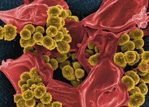 Ảnh hiển vi điện tử quét màu chụp lại vi khuẩn Staphylococcus vàng kháng methicillin (MRSA) (màu vàng) tương tác với bạch cầu đa nhân trung tính ở người (màu đỏ). Nguồn: Viện Dị ứng và Bệnh truyền nhiễm Quốc gia Hoa Kỳ (NIAID).